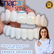 Promo Snap On Smile 100% Original Authentic / Snap 'N Smile Gigi