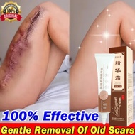 Scar Removal Cream Scar Repair Cream Acne Scar Remover  For Old And New Scar Face and Body Skin Repa