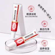 Freckle Removal Cream Whitening Niacinamide Freckle Blemish Blemish Blemish Blemish Blemish Blemish 