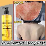 Anti Mite Itching Shower Gel Itchy Skin Sophora Flavescens Acne Shower Gel to Remove Mites Whitening