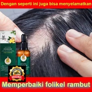 CUCI GUDANG... Serum Ampuh untuk Rambut Rontok Parah - Penumbuh Rambut secara Cepat dan Tebal - Hair