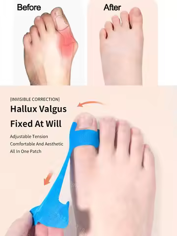 Kinesiology Tape Hallux Valgus Big Toe Corrector Tape for Sports Waterproof Protective Tape Toe Corr