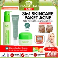 Reglow 3in1 Acne Facial Wash Cream Gel Package [Live Sale] Reglow Acne Original Dr Shindy Package