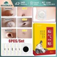 6pcs Herbal Hernia Patch For Children Umbilical Hernia Belt Baby Anti-Blow Down/ Hernia Patch/ For B