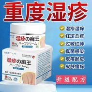 Special Effect Quick Anti-itch Cream 4.6