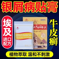 Cowhide Cowhide Moss Silver Scraps Disease Patch Cream Skin Itching Flower Spots Eczema Anti-Itching