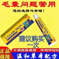 Genuine Scalp Itchy I Creep I Creep Scalp Antibacterial Repair Herbal Cream Formula Relieve Itchy Sc