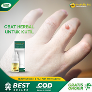 Obat Penghilang Kutil Anak Dan Dewasa - Obat Kutil Di Tangan - Obat Kutil Di Kaki - Obat Perontok Ku