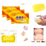 Sulfur Bath Soap Sulfur Soap for Itchy Skin, Fungus, Tinea Versicolor, Allergies AM