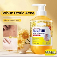Sulfur shower gel for treating psoriasis,eczema,remove acne, exfoliating,itching,moisturizing,antiba