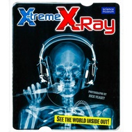 X-Treme X-Ray ISBN: 9781847324894
