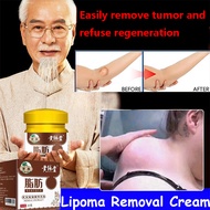 Lipoma Cream Benjolan Ubat Benjolan Krim Lipoma Removal Cream Original Removing Multiple Single Lipo