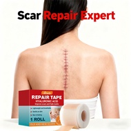 ☑️“COD”Silicone scar tape Silicone Scar Sheet keloid scar remover Scar silicone sheet scar patch疤痕贴