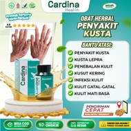 Cardina Health Squalene Softgel Medicine for Itchy Skin Infections, Thickening, Dry Skin, Infertilit
