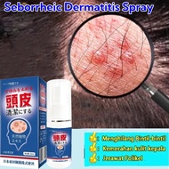 Seborrheic Dermatitis Scalp Spray – 30ml Treatment for Psoriasis, Dandruff & Itchy Scalp