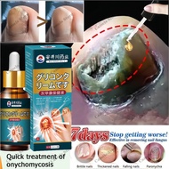 Nail Repair Essence Inhibit Fungal Nail Fungal Treatment Nail fungus