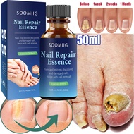 Nail Repair Serum Nail Fungal Treatment Serum Onychomycosis Paronychia Anti-Fungal Nail Infection Toe Fungus Foot Repair Care