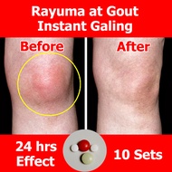 Notiku Arthritis Rayuma Gout Relief 10 Sets, Arthritis Medicine, gloves, spray, patch, slippers, socks, gout medicine, gout cream, gout relief, gout out, gout support, goutrin, gout supporter, gout and you, gout supplement