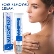 【Fast-Acting Scar Fading】 Professional Scar Repair Cream For All Skin Types Scar Cream/Scar Treatmen