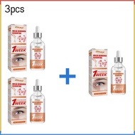 South Moon milia remover serum penghilang milia 7 days Serum Penghilang Milia Kutil di bawah Mata Ey