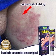 Dermovate ointment Anti fungal cream Dermovate cream Eczema cream Psoriasis crea Anti itch cream 30g