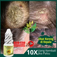 Obat Koreng Herbal, Obat Koreng di kepala, Obat Luka Koreng di Kulit Kepala, Obat Oles Koreng di Kepala, Salep untuk Koreng di Kepala Anak dan Dewasa, Obat Penghilang Bekas Koreng di Kepala, Psoriasis Kepala, Ketombe Berkerak, Jamur di Kepala Propolis SM