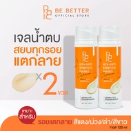 ครีมลดรอยแตกลาย Be Better 2ขวด ก้นลาย ขาลาย ท้องลาย น้ำเหลืองไม่ดี คนท้องใช้ได้