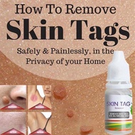 SKIN TAG REMOVER MEMBUANG KETUAT KUTIL TAHI LALAT BINTIK HITAM mole remover wart remover bersihkan k