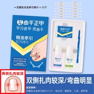 เครื่องปรับรูปเล็บได้ Curved Flat Corrector Nail Clipper สำหรับเล็บผู้ชายและผู้หญิง อุปกรณ์ดูแลเล็บใ