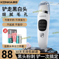【滿額免運】koa/黑頭鏟超音波美容儀家用鏟吸去黑頭神器粉刺收毛孔面部