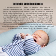 Repeatable Umbilical hernia band for infants Umbilical hernia Belt or Disposable Infants Umbilical H