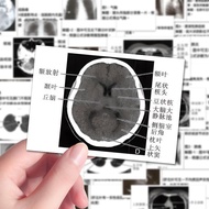 特惠！96张学影像CT拍片分析贴纸学知识科普放片解析实用防水贴画 Special offer 96 CT scan analysis stickers for learning knowledge a