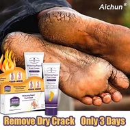 Whitening repair foot cream Kem Ngăn Ngừa Và Hồi Phục Nứt Nẻ Gót Chân//Foot care100ML