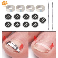 [Lacooppia2] Ingrown Toenail Corrector Tools Kit Toenail Lifter Embed Toe Nails Treatment Pedicure R