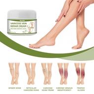 Eelhoe Varicose Vein Repair Cream Effective Convenient Plant Extracts Varicose Vein Repair Cream Relieve Pain Legs for Postpartum Obese People（50g）