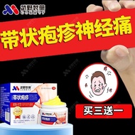 Strongly penetrating skin herpes zoster cream, sequelae, neuralgia, itching, snake强渗透皮肤带状疱疹膏后遗症神经痛痒蛇