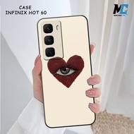 Montana - Silicone Casing For Infinix Hot 60 | Infinix Hot 60i | Infinix Hot 60 Pro | Infinix Hot 60