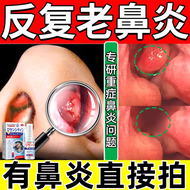 【日本监制】岩井昃弘制药过敏性鼻炎鼻窦炎喷剂喷雾成人抗过敏通窍洗鼻10%膏0凝胶效专特用贴颗粒器 1盒体验装【鼻塞流涕】