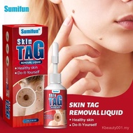 Skin tag removal cream 30g，Remove HPV Warts、various skin warts