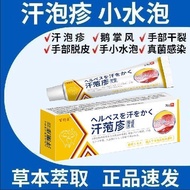 2026新品汗疱疹手上起小水泡手足痒脱皮止痒皮肤瘙痒真菌感染抑菌Dyshidrotic eczema causes small blisters on the hands, with itching 