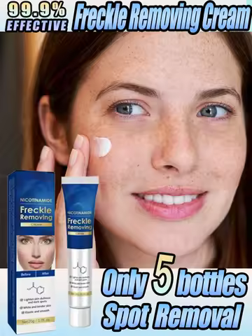 Effictive Dark Spot Remover cream for Face Removing Freckle Melasma Chloasma Senile Plaques Sunburn 