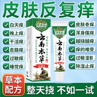 Anti-itch King Antibacterial Cream Whole Body Anti-itch Cream Sterilization Athlete's Foot Cream Ant