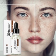 Hymeys Niacinamide Serum Muka Jeragat Melasma Dark Spots Freckles Remover 祛斑