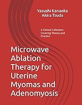 Microwave Ablation Therapy for Uterine Myomas and Adenomyosis: A Clinical Collection Covering Theory