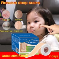 Scar Removal Medical Silicone Scar Sheet 4cmx50cm Scar Gel/Keloid Scar Plaster/Scar Removal Patch