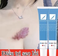 [CHÍNH HÄNG ] Kem mö seo mö thâm seo lôi seo löm seo do mun giúp mò seo và giam ran da hiêu quà 20g