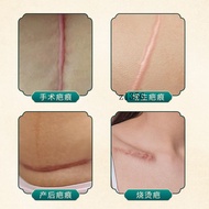 Thai Scar Cream Skin Scar Repair Cream Postpartum Scar Growth Skin Scar Application Cream