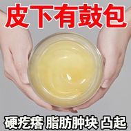 Hong Kong Fat Kang Tumor Block Cream Fat Spirit Cream Tumor Hard Block Drum Bag Single Hair Multi-Ha