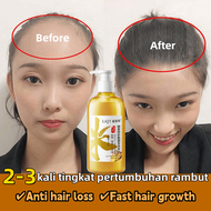 Shampoo Penumbuh Rambut Botak Penumbuh Rambut Cepat Dan Menhitamkan Rambut anti rambut rontok Shampo Jahe