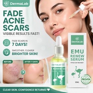 Dermalab Emu Renew Serum with Emu Oil for Pitted Scar Treatment, Fade Scars, Brighten Skin, 30ml